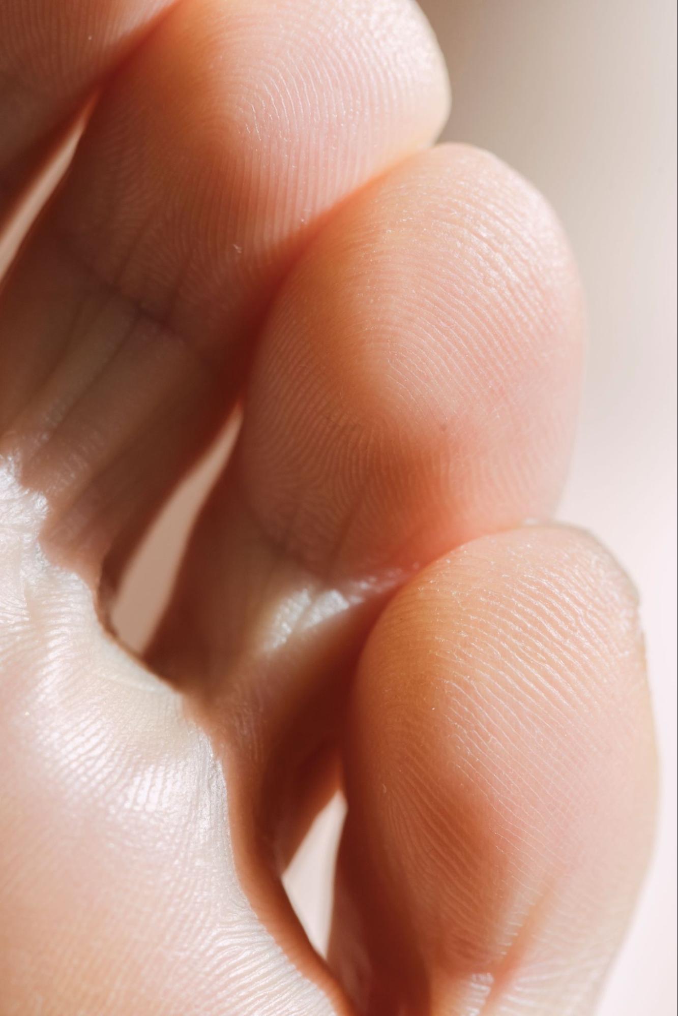 A close-up of dry skin between the toes