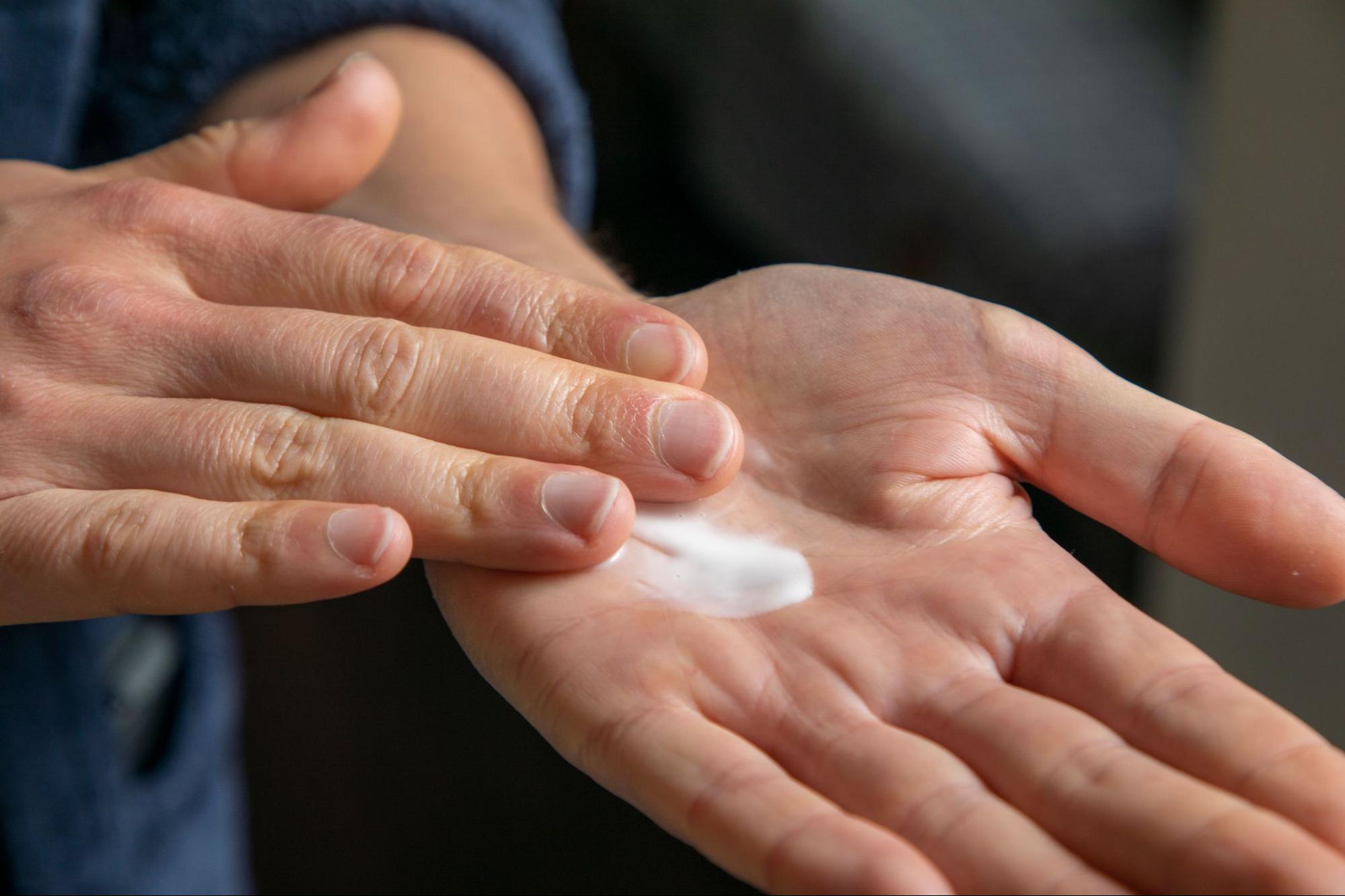 A person applying moisturising cream to the palm of their hand